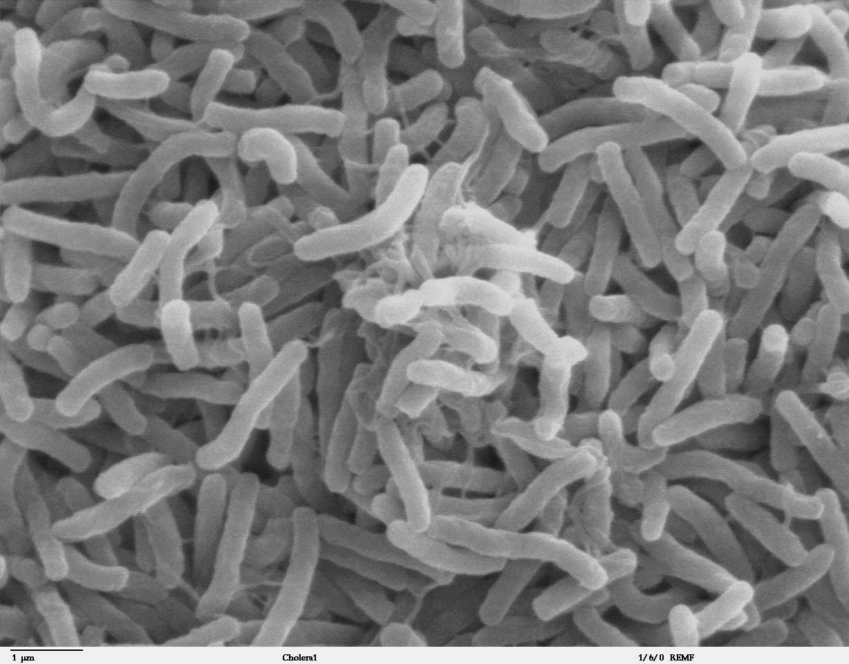 https://mednl.net/wp-content/uploads/2020/11/Cholera_bacteria_SEM.jpg