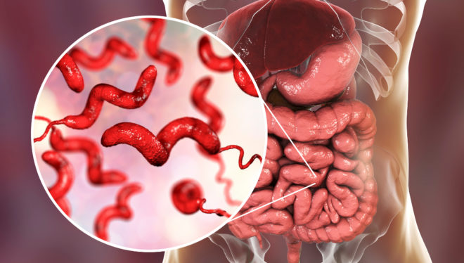 Campylobacter-infectie: symptomen en behandeling