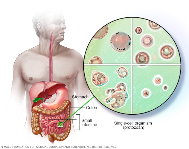 Blastocystis hominis - oorzaken, symptomen en behandeling