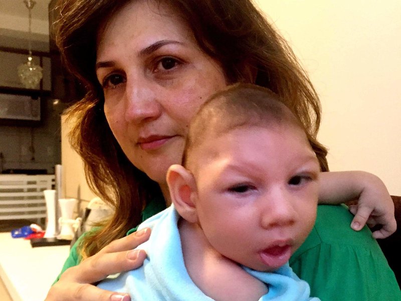 Marilla Lima, een Braziliaanse moeder, had tijdens haar zwangerschap het Zika-virus.  Haar 2,5 maanden oude zoon Arthur heeft microcefalie - een geboorteafwijking die wordt gekenmerkt door een klein hoofd en ernstige hersenbeschadiging. 