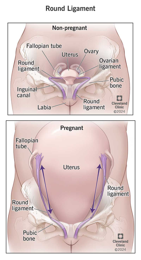 Ronde ligament van de baarmoeder