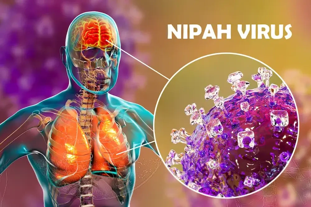 Nipah-virus: huidige situatie en betekenis voor Nederland